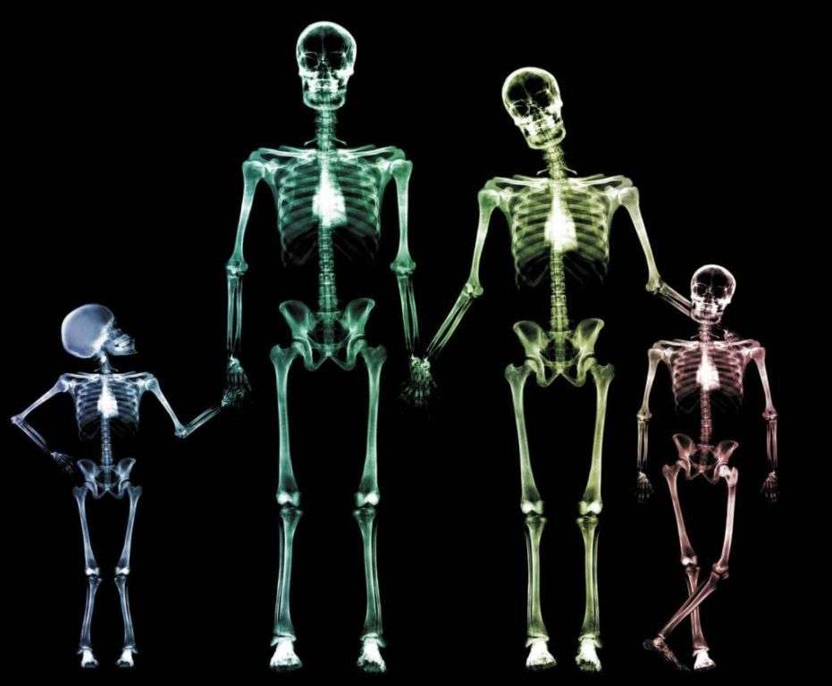 Доброкачественные опухоли костей: виды, причины, симптомы, диагностика и лечение Здоровье