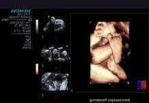 Дитини в утробі розглянуть у стереоокулярах