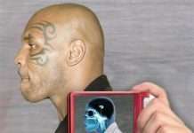 Знаменитості під рентгенівськими променями (29 фото)