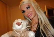 Дівчата і хлопці, явно переборщившие з ботоксом (33 фото)