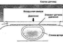 Мініатюрний імплантується сенсор визначить тиск