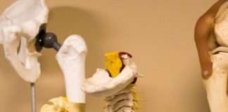 Доброякісні пухлини кісток: види, причини, симптоми, діагностика і лікування