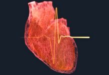 Ризик серцевих нападів у чоловіків зростає раніше, ніж вважалося раніше: нове дослідження підкреслює необхідність ранньої діагностики